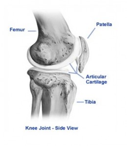 cartilage damage