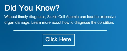 sickle cell anemia diagnosis